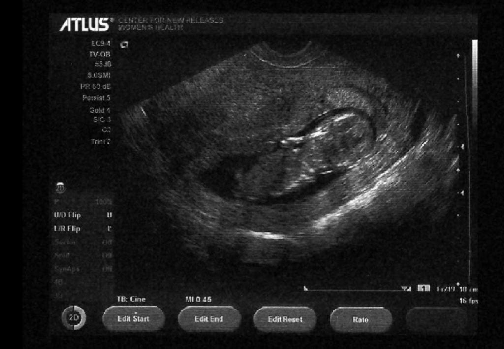 ATLUS USA Launch Mystery Teaser Website - Potentially Hospital Related 1 ATLUS